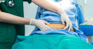 Read more about the article Recovery After Gynaec Laparoscopic Surgery: Tips